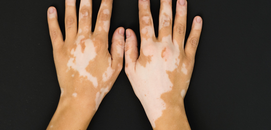 Dr Purva Skin Clinic