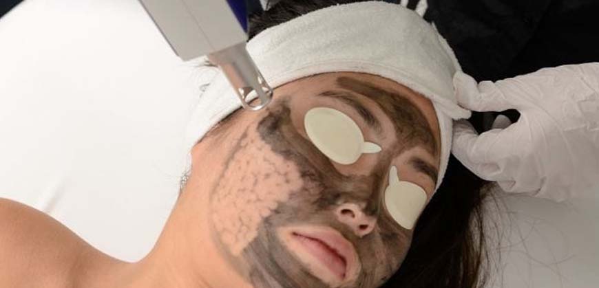 Carbon Laser Tonning in Panchkula
