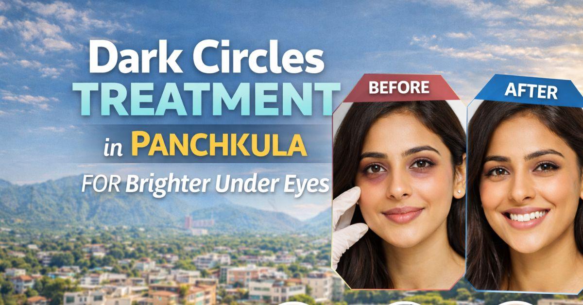 Dark Circles Treatment in Panchkula for Brighter Under Eyes